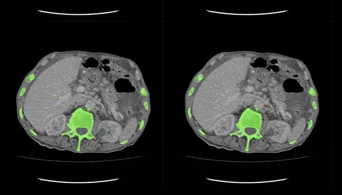 What Is AI Data Labeling in Medical Imaging?