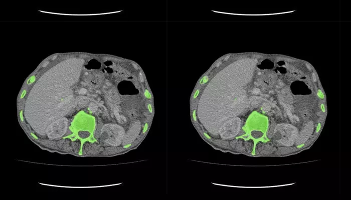 What Is AI Data Labeling in Medical Imaging?