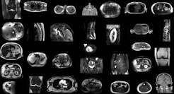 10 Best AI Image Segmentation Tools for MRI & CT Scans